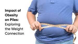 Exploring Obesity's Effects On Digestive Health